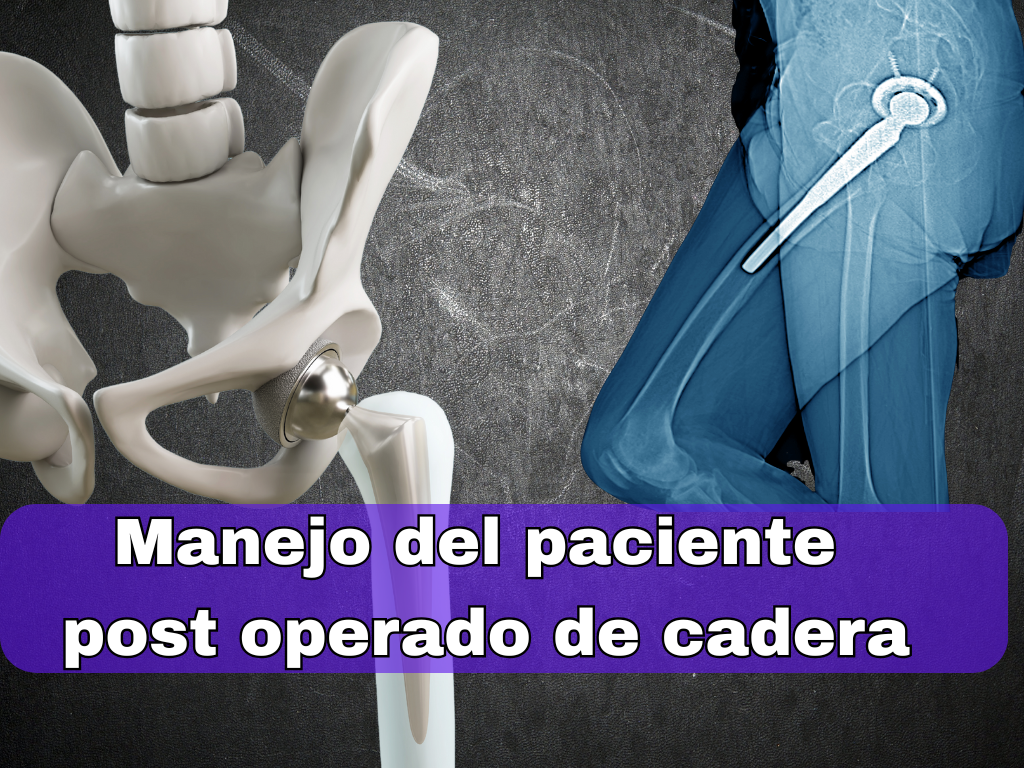 Curso de manejo efectivo del paciente Post-Operado de cadera